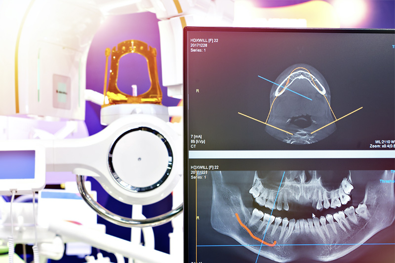 Laser Dentistry in 